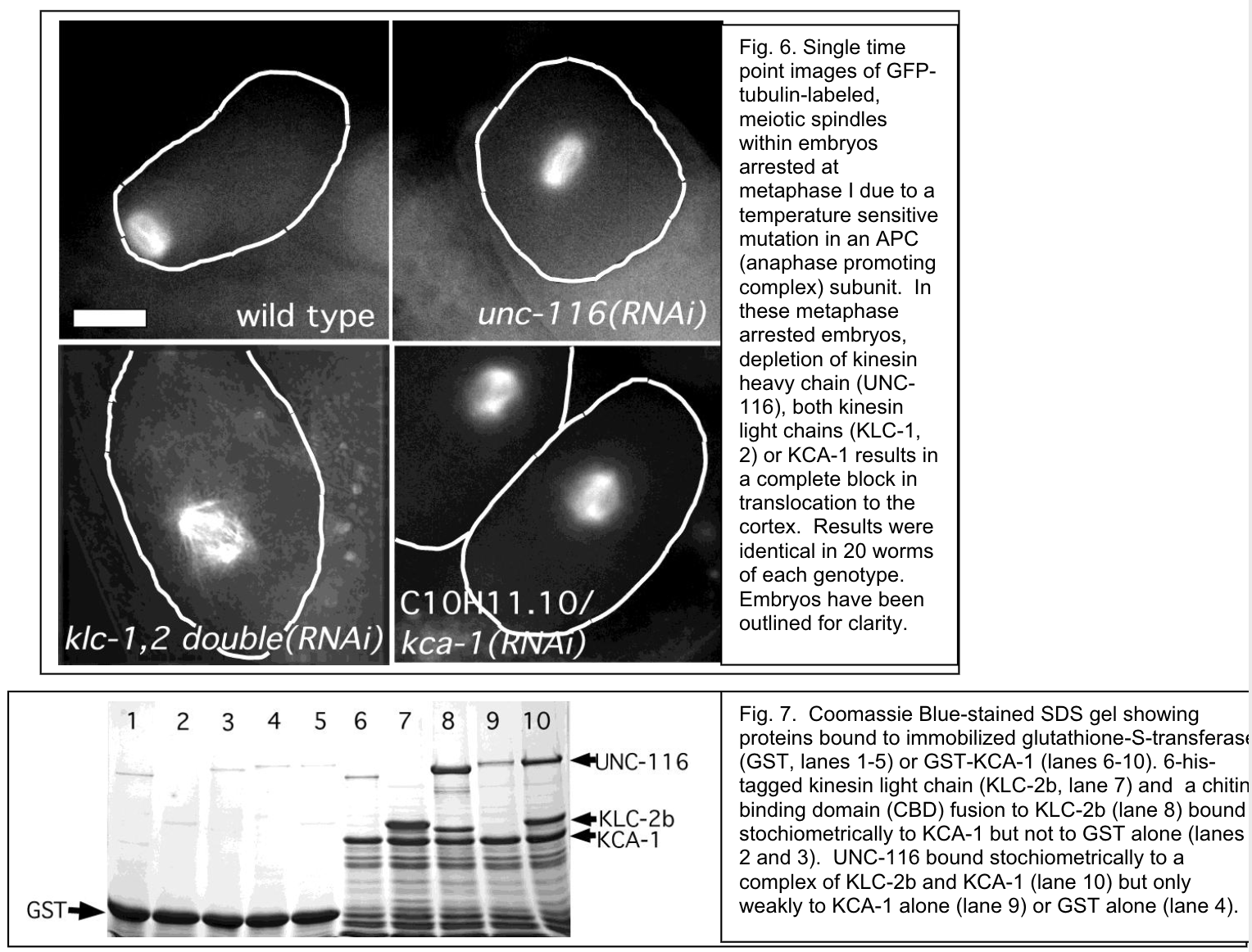 Fluorescent micrographs of wild-type and mutant yeast showing nuclear signal, with protein gel blot